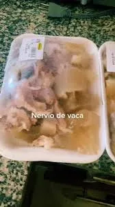 NERVIOS
